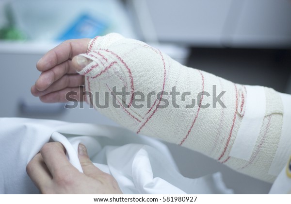 患者の前腕と手首にギプスと包帯を施し 骨折損傷後に固定する医師 の写真素材 今すぐ編集