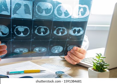 Doctor At Appointment Inspects And Examines Ct Scan Of Chest And Abdominal Cavity. Concept Photo On Diagnosis Of Diseases In Pulmonology, Lung Pathology, Inflammatory Diseases Of Bronchi, Tuberculosis