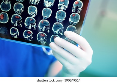 Doctor attentively examines the MRI scan of the patient. - Shutterstock ID 390249514