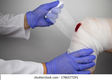 The Doctor Bandages The Knee Of A Girl Who Is Injured. Stopping Bleeding By Applying A Pressure Bandage To The Injury. First Aid For Injuries. The Technique Of Applying A Cruciform Bandage.