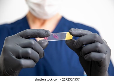 doctor in black gloves holds stained histology slide which is ready for microscopic examination. Cytology. 