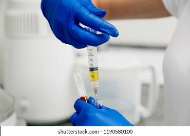 Doctor In Blue Gloves Keep In Hands Test Tube With A Blood And Plasma. Syringe With Platelet Rich Plasma. Beauty Injection. Prp. Centrifuge