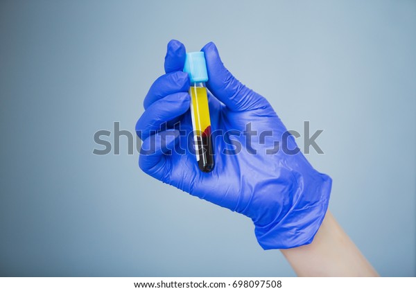 Doctor in blue gloves keep in hands test tube with a\
blood and plasma. Syringe with platelet rich plasma. Beauty\
injection 