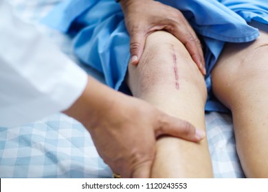 Doctor check Asian senior or elderly old lady woman patient scars surgical total knee joint replacement Suture wound surgery arthroplasty at nursing hospital ward : healthy strong medical concept.
