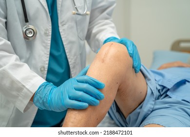 Doctor check Asian senior or elderly woman patient scar surgical total knee joint replacement Suture wound surgery arthroplasty on bed in nursing hospital ward, healthy strong medical concept. - Shutterstock ID 2188472101