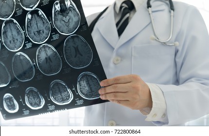 Doctor check up x-ray film of the brain by ct scan brain at patient room hospital.