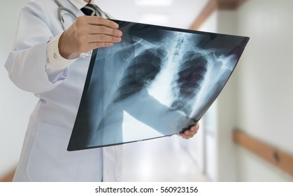doctor checking chest x-ray film at ward hospital.