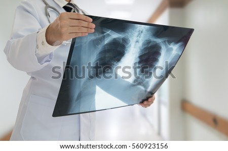 doctor checking chest x-ray film at ward hospital.