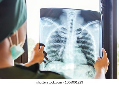 Doctor checking examining chest x-ray film of patient at ward hospital.