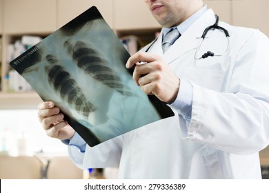 A Doctor Checking X-ray Photo Of Patients. Xray Of Lungs. Hospital. Medical Check. 