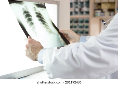 A Doctor Checking X-ray Photo Of Patients. Xray Of Lungs. Hospital. Medical Check. 