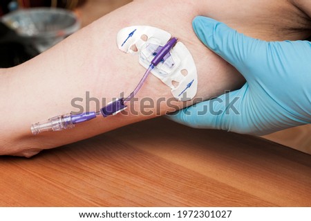 Doctor checks the PICC line on the arm of a woman undergoing chemotherapy for breast cancer