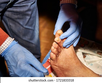 Doctor Cleaning Fungus On The Big Toe Of An Elderly Diabetic