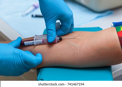 The Doctor Collects Blood In A Syringe, Nurse Takes Blood From The Veins On The Arm
