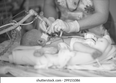 Doctor Connecting A Baby To Mechanical Ventilator