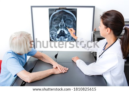 Doctor consider and discuss with senior patient X-ray of her head and maxillary sinuses. Diagnostics and treatment of sinusitis and frontal sinusitis