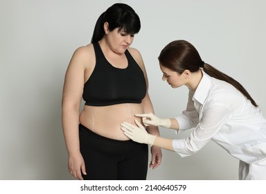 Doctor Consulting Obese Woman On Light Background. Weight Loss Surgery