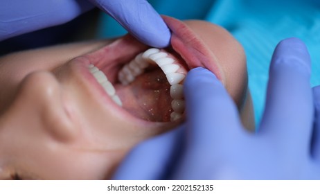 Doctor dentist examining patient oral cavity with veneers closeup - Shutterstock ID 2202152135