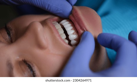 Doctor dentist examining teeth with veneers of female patient in clinic closeup - Shutterstock ID 2304264971