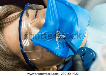 Doctor dentist using of rubber dam system with latex scarves and metal clips. Restoration chewing surface with photopolymer filling material