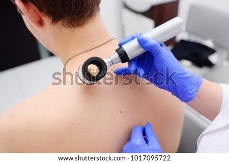 the doctor dermatologist examines birthmarks and birthmarks of the patient with a dermatoscope. Preventive maintenance of a melanoma