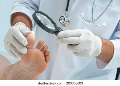 Doctor dermatologist examines the foot on the presence of athlete's foot - Powered by Shutterstock