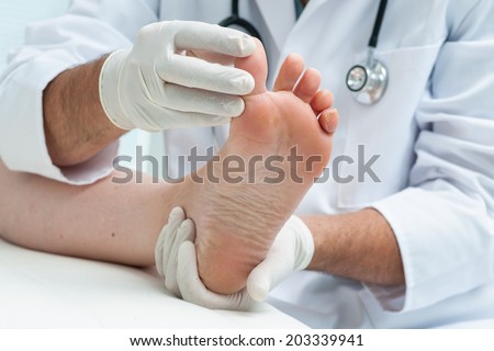 Doctor dermatologist examines the foot on the presence of athlete's foot Zdjęcia stock © 
