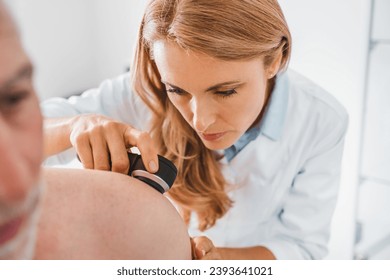 Doctor dermatologist examines skin of patient. Dermatoscopy, prevention of melanoma, skin cancer. - Powered by Shutterstock