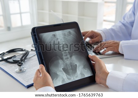 doctor diagnose pelvis hipbone sacrum coccyx spine x-ray image on digital tablet screen with radiologist  team.