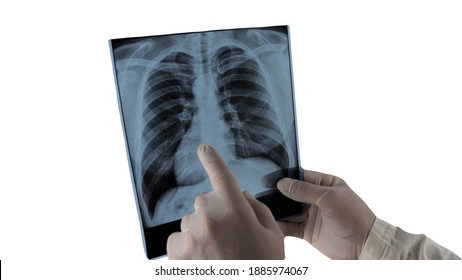 Doctor Looking Xray Lungs Clinic Medical Stock Photo 1908073477 ...