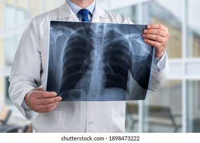 Doctor Diagnosing Patientâ€™s Health On Asthma, Lung Disease, COVID-19 Or Bone Cancer Illness With Radiological Chest X-ray Film For Medical Healthcare Hospital Service