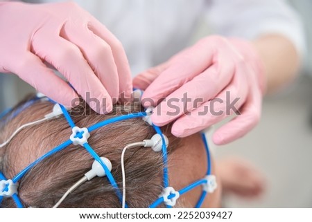 Doctor diagnostician removes electrodes from the head of elderly patient