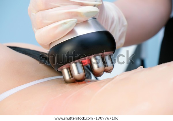 doctor does the Rf lifting procedure on the legs,\
buttocks and back, hips of a woman in a beauty parlor. Treatment of\
overweight and flabby\
skin.