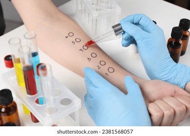 Doctor doing skin allergy test at light table, closeup - Powered by Shutterstock