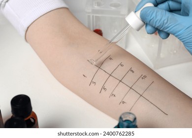 Doctor doing skin allergy test at light table, closeup - Powered by Shutterstock