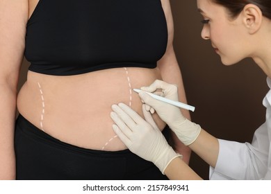 Doctor Drawing Marks On Obese Woman's Body Against Brown Background, Closeup. Weight Loss Surgery