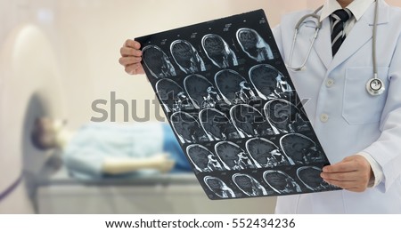 Doctor examine film x-ray the brain by mri scan of the patient.