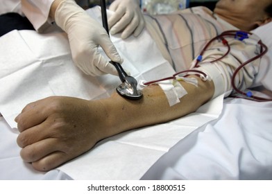 Doctor Examines The Arm Of Patient With Dialysis Shunt.