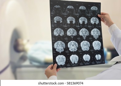Doctor examines film x-ray brain by mri of the patient at ct scan room.