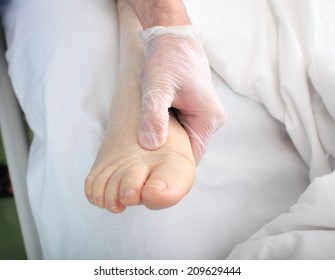 Doctor Examines Foot Of Heavy Patient With Edema