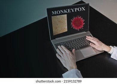 A Doctor Examines The Microscopy Of The Monkeypox Infection Virus. Monkeypox Cage With Doctor At The Table. Pandemic Monkeypox Is A Rare Disease Caused By A Virus. Infection In Africa, Europe.