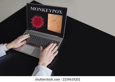 A Doctor Examines The Microscopy Of The Monkeypox Infection Virus. Monkeypox Cage With Doctor At The Table. Pandemic Monkeypox Is A Rare Disease Caused By A Virus. Infection In Africa, Europe.