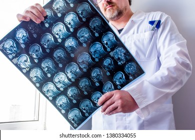 Doctor examines MRI scan of head, neck and brain of patient, holding in hands. Concept photo of instrumental diagnostics anatomy of organs of nervous system to determine cause of disease like headache