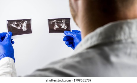 The doctor examines the ultrasound images of the prostate gland,prostate pictures in the hands of a medical worker,on a white background - Shutterstock ID 1799551789