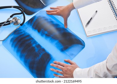 Doctor Examines X-ray Image Of Lungs Lying On The Light Table. Pulmonology Medicine Concept