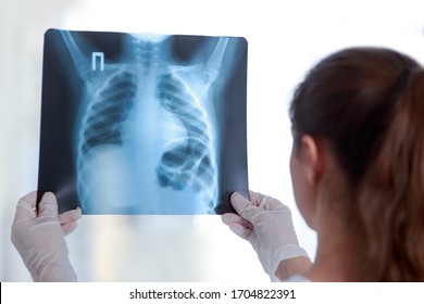 Female Doctor Radiologist Examines Chest Xray Stock Photo 1927224815 ...