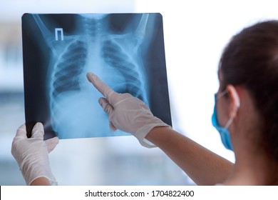 Doctor examines an X-ray of a lung - Powered by Shutterstock