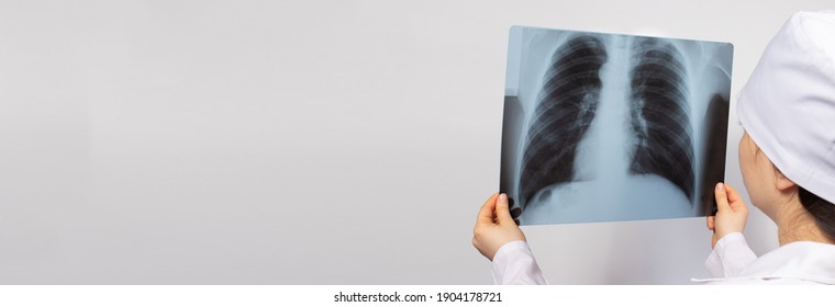 A Doctor Examines An X-ray Of The Lungs Of A Patient With Pneumonia. Pulmonology And Radiology, Lung Disease. With Place For Text Copy Space.