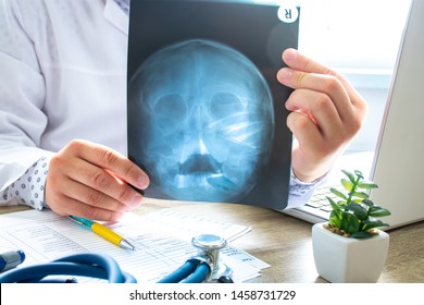 
Doctor examines x-ray scan of head and skull near computer during work and patient advice in office. Diagnostics of diseases of ear, nose and throat, adenoids, abnormalities of skull, brain, bones