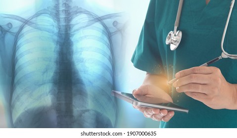 Doctor examining chest x-ray image to diagnose pneumonia lung, emphysema. lung radiography concept.